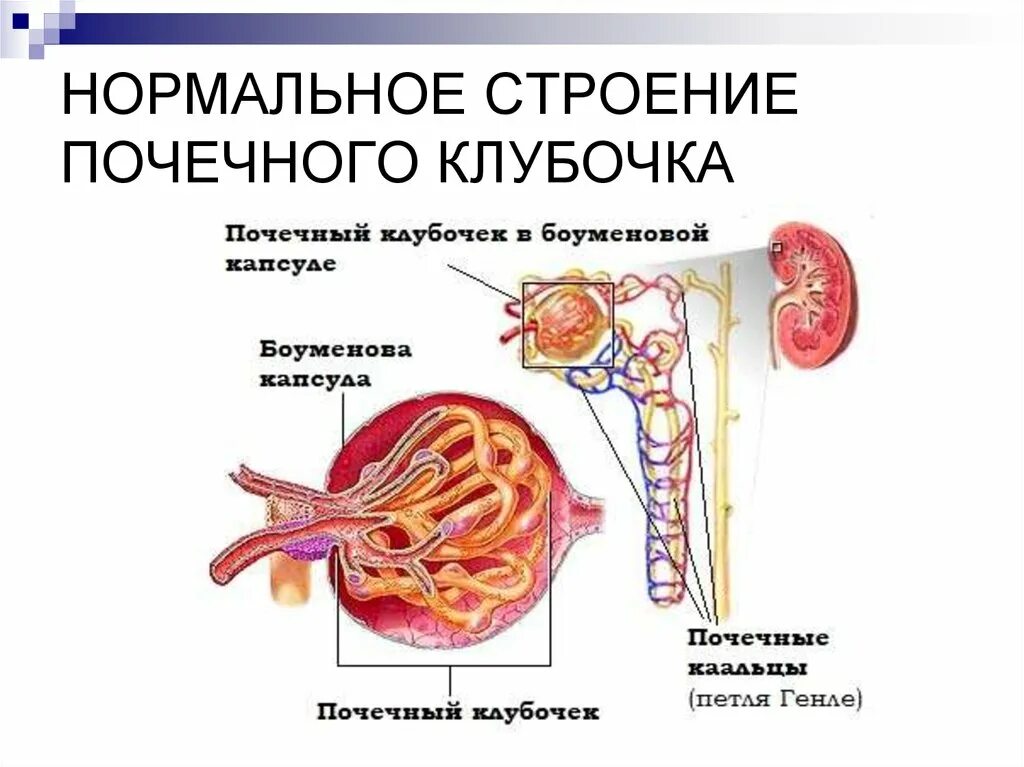 Нормальное строение. Гломерулонефрит почечный клубочек. клубочек почки гломерулонефрит. строение почки клубочки канальцы. почки строение почечного клубочка.