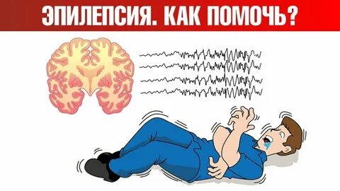 Эпилептик