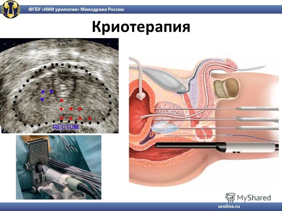 Урология минздрав. Войтко уролог НИИ урологии Лопаткина. Схема урологии мужчины.