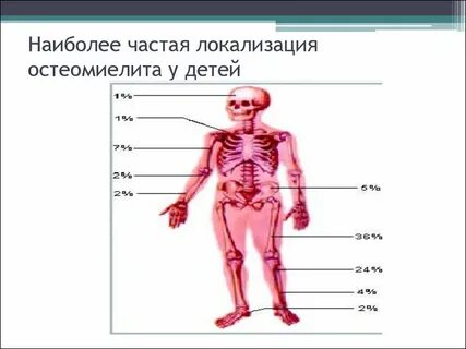 Наиболее частая локализация