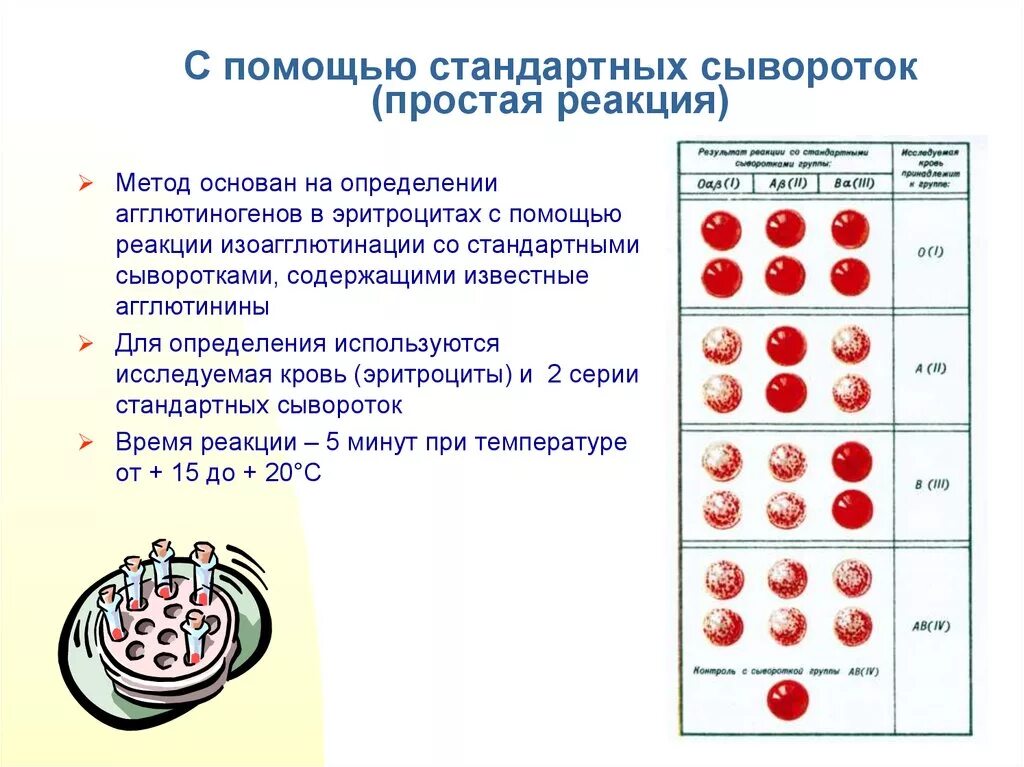 2 группа крови определение. Определение группы крови стандартными сыворотками. Метод стандартных изогемагглютинирующих сывороток. Определить группу крови с помощью стандартных сывороток. * Алгоритм группа крови с сывороткой.