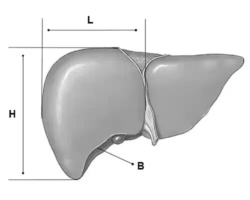 4 размера печени. Размер человеческой печени. Поперечный размер печени. Размеры печени КВР. Косо вертикальный размер печени.