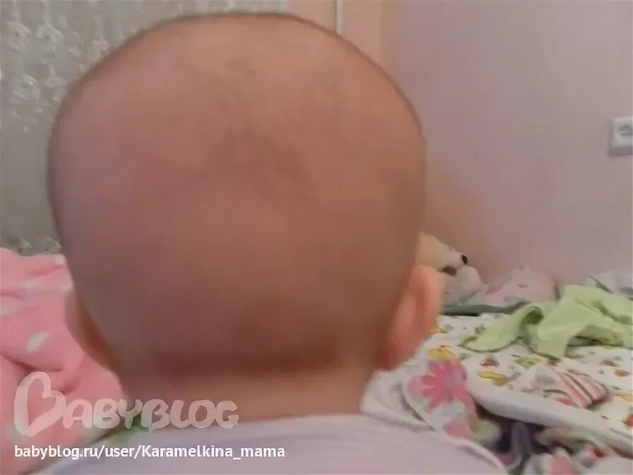 Форма головы новорожденного Родничок. Вмятина на затылке у ребенка.