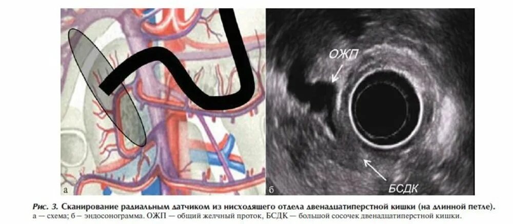 Эус желудка. Эндосонография поджелудочной железы. Эндосонография желудка. Эндосонография кишечника. Эндосонография желчных протоков.