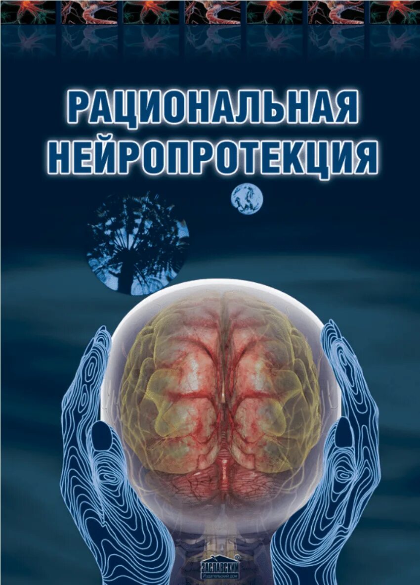 Нейропротекция. Беленичев и.ф., черний в.и. - рациональная нейропротекция. Монографии по неврологии. Книги по нейрохирургии. G45.0 синдром вертебробазилярной артериальной системы.