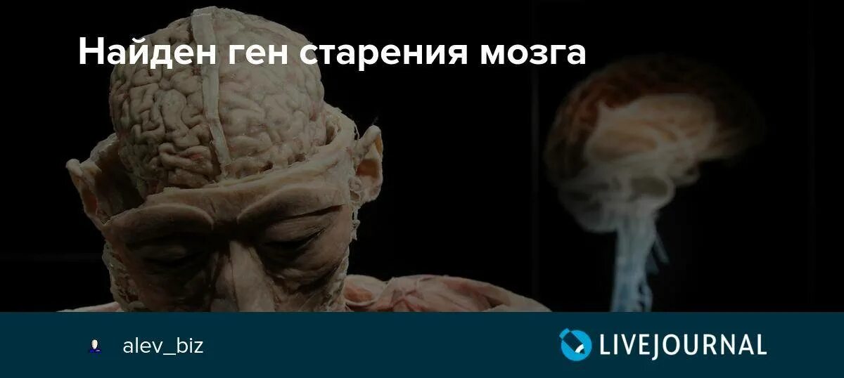 Нестареющий мозг. Старение мозга. Процесс старения мозга. Японский мозг на старение мозга. Тест на старение мозга.