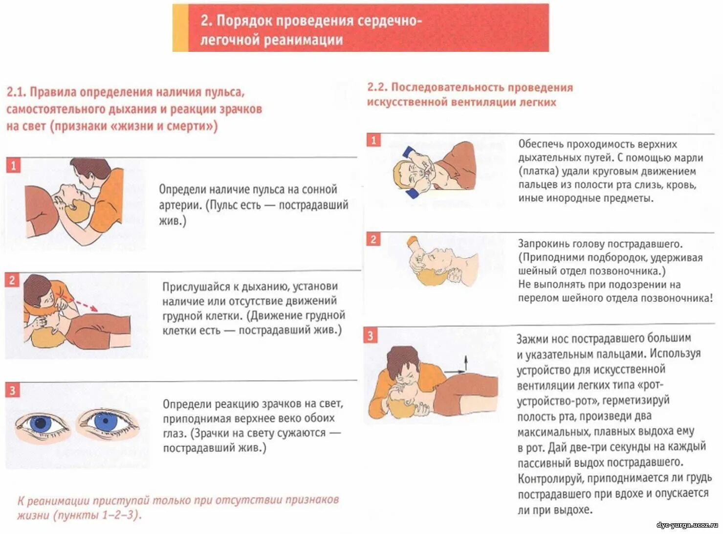 Этапы догоспитальной реанимации. Порядок проведения сердечно-легочной реанимации реанимации. Порядок проведения СЛР сердечно-легочной реанимации. Правило и порядок проведения сердечно легочной реанимации. Перед тобой этапы проведения сердечно легочной реанимации.