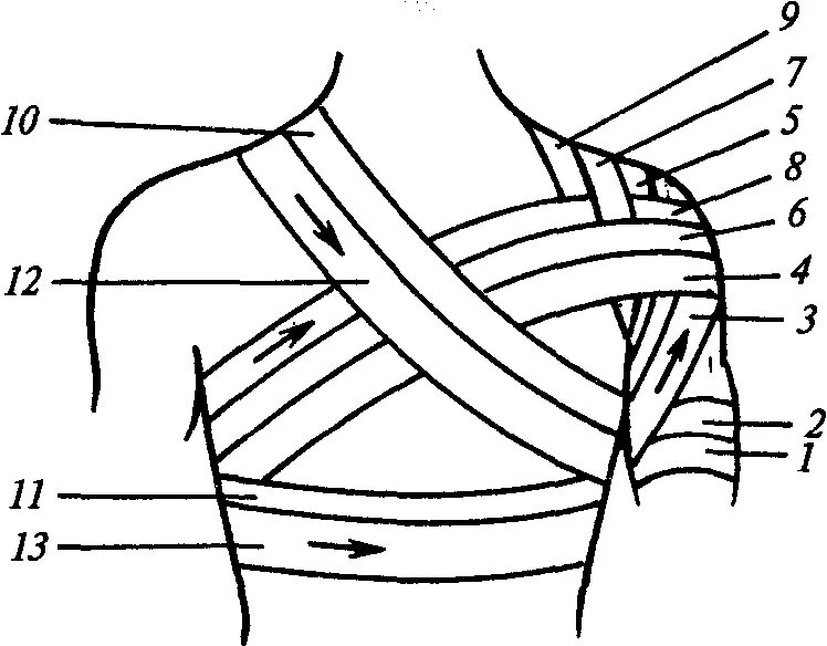 Как перевязать карту. Колосовидная повязка Дезо. Перевязка колосовидная на плечо. Колосовидная повязка на плечевой сустав. Перевязка плечевого сустава эластичным бинтом.