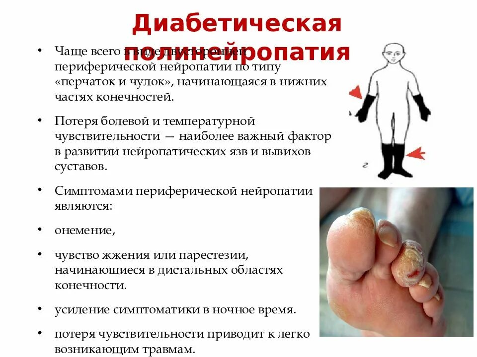 Умирают ли от эндокринопатии. Тема эндокринопатии презентация. диабетические эндокринопатии. распространенность эндокринопатий. кожные проявления эндокринопатий.