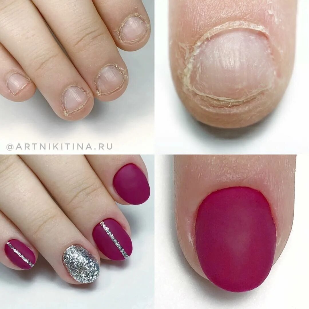 Трапециевидная форма ногтей. Маникюр форма трапеция. Трапециевидные ногти. Широкие трапециевидные ногти. Трапециевидные ногти какую форму.