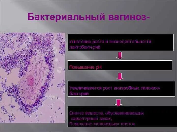 Бактериальный вагиноз мазок микроскопия. Бактериальный вагиноз и лактобактерии. Вагинит и вагиноз