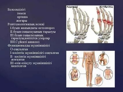 Іш киімнің эротикалық фотосуреттері