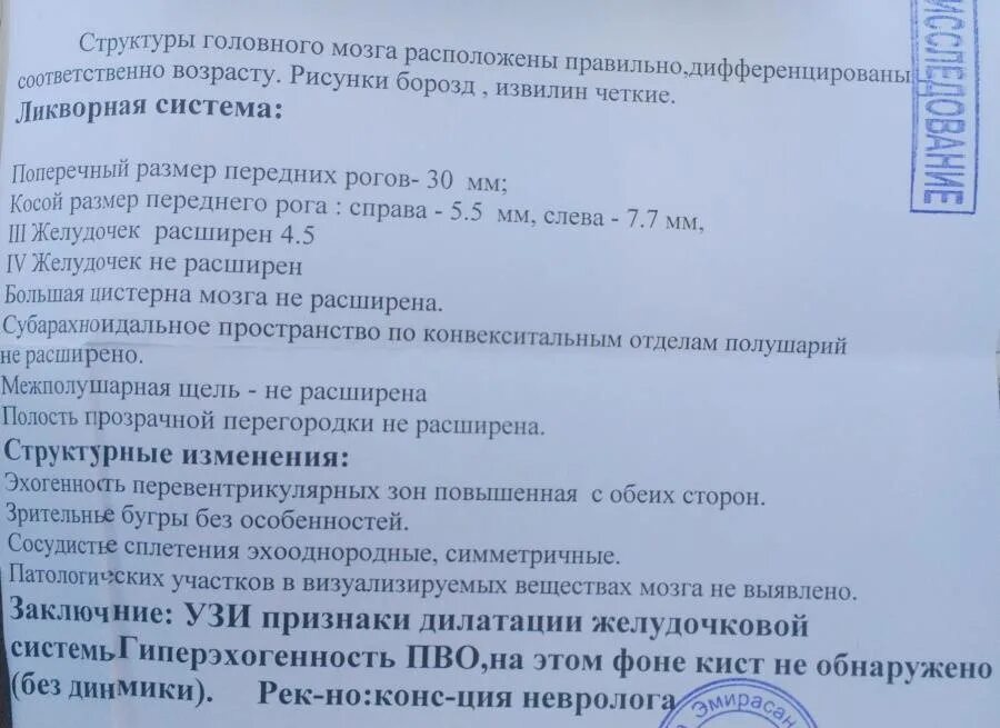 Расширение желудочков у новорожденного. УЗИ головного мозга у новорожденных желудочки норма. Расширение боковых желудочков головного мозга у новорожденных норма. Нейросонография головного мозга грудничка норма. Норма УЗИ головного мозга в 1 месяц ребенку.