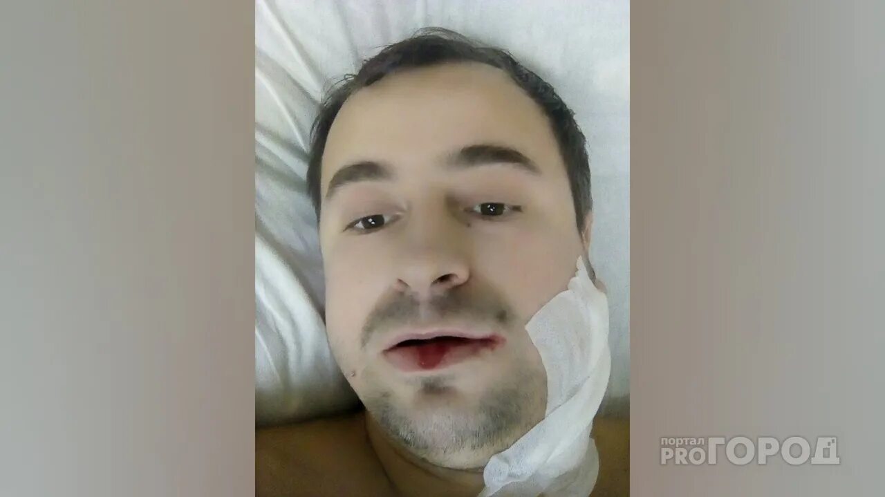 Лечение переломов длинных костей в Хабаровске - Медикъ