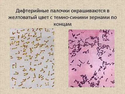 Дифтерийная палочка