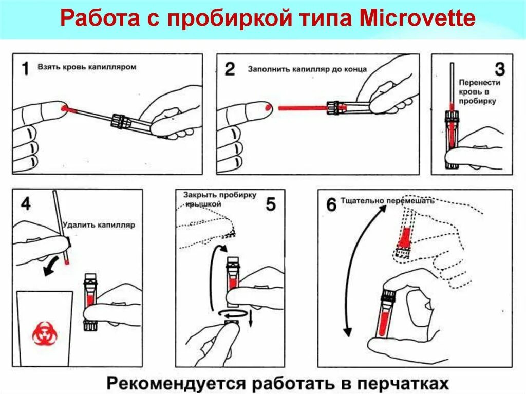 Забор анализов алгоритм. Забор капиллярной крови алгоритм. методика взятия капиллярной крови для исследования. взятие капиллярной крови из пальца алгоритм. алгоритм взятия капиллярной крови у детей.