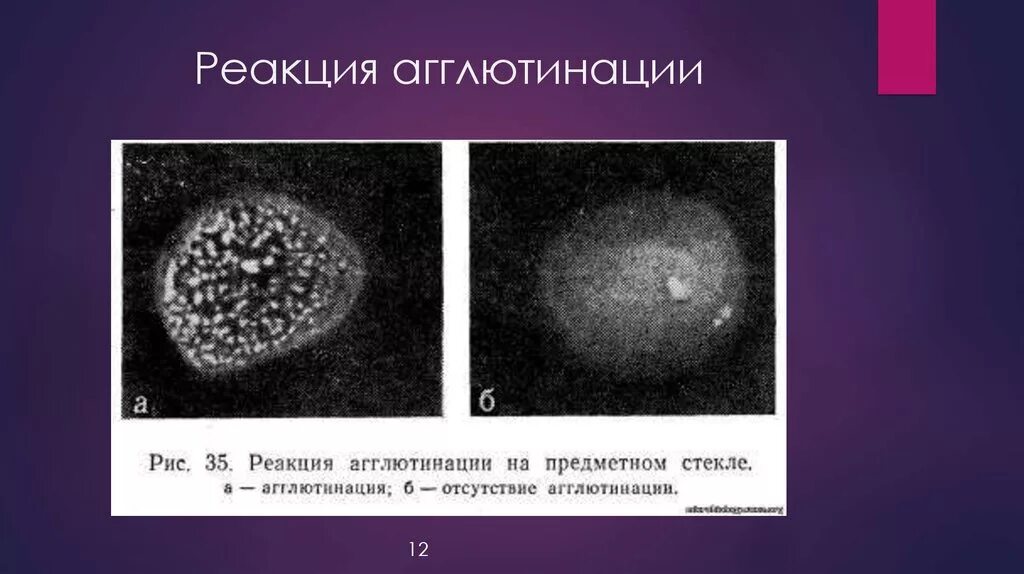 Реакция агглютинации реагенты. Реакция агглютинации сальмонелл. реакция агглютинации сальмонелл на стекле. реакция агглютинации микробиология. реакция агглютинации бактерий.