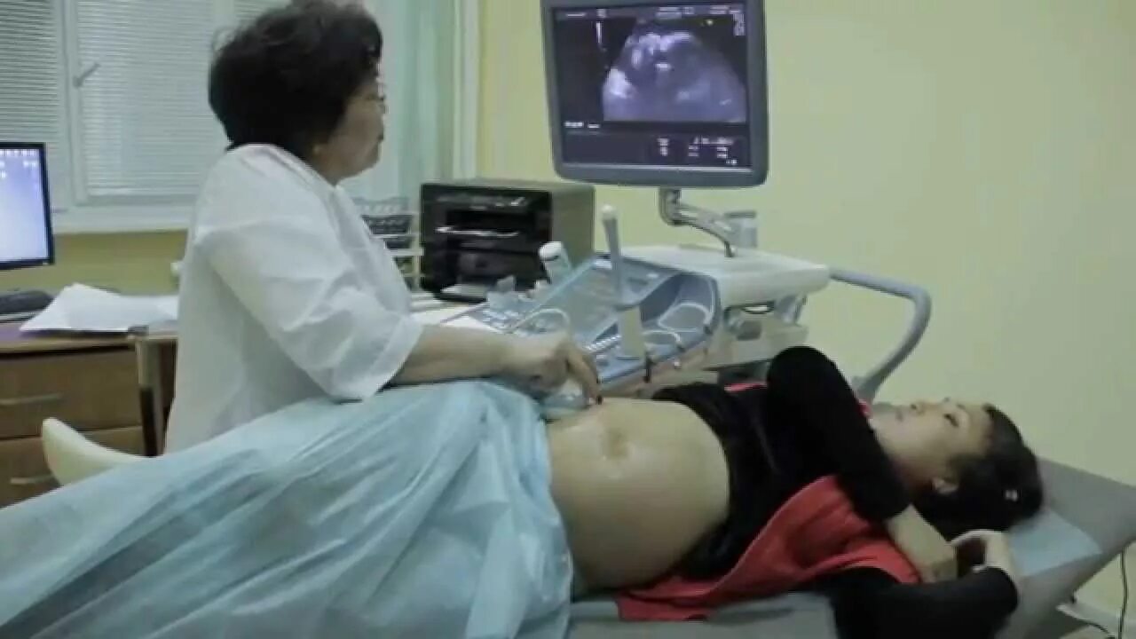 Видео 3д УЗИ беременных. Примамед УЗИ.