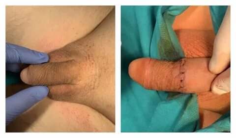Alginat penis - 🧡 Pauly ds penis ✔ Структура полового члена (61 фото) .