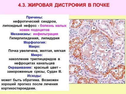 Жировая почка