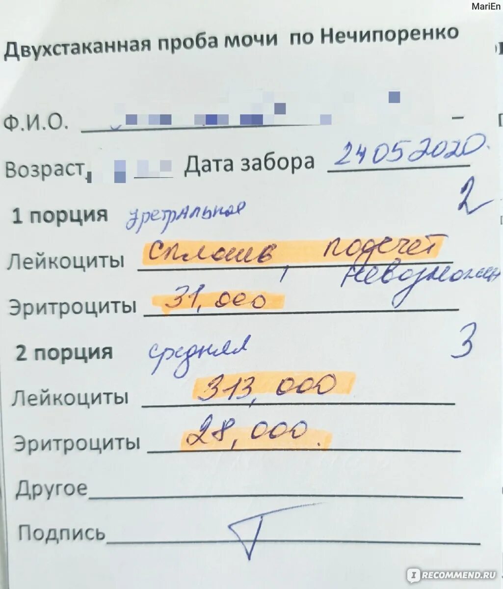 Можно ли сдавать мочу если пьешь. Показатели анализа мочи по Нечипоренко. Нечипоренко анализ мочи норма. Анализ мочи по Нечипоренко норма у детей. Анализ мочи по Нечипоренко лейкоциты 0,25.