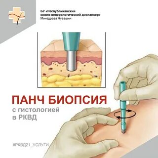 Панч биопсия кожи