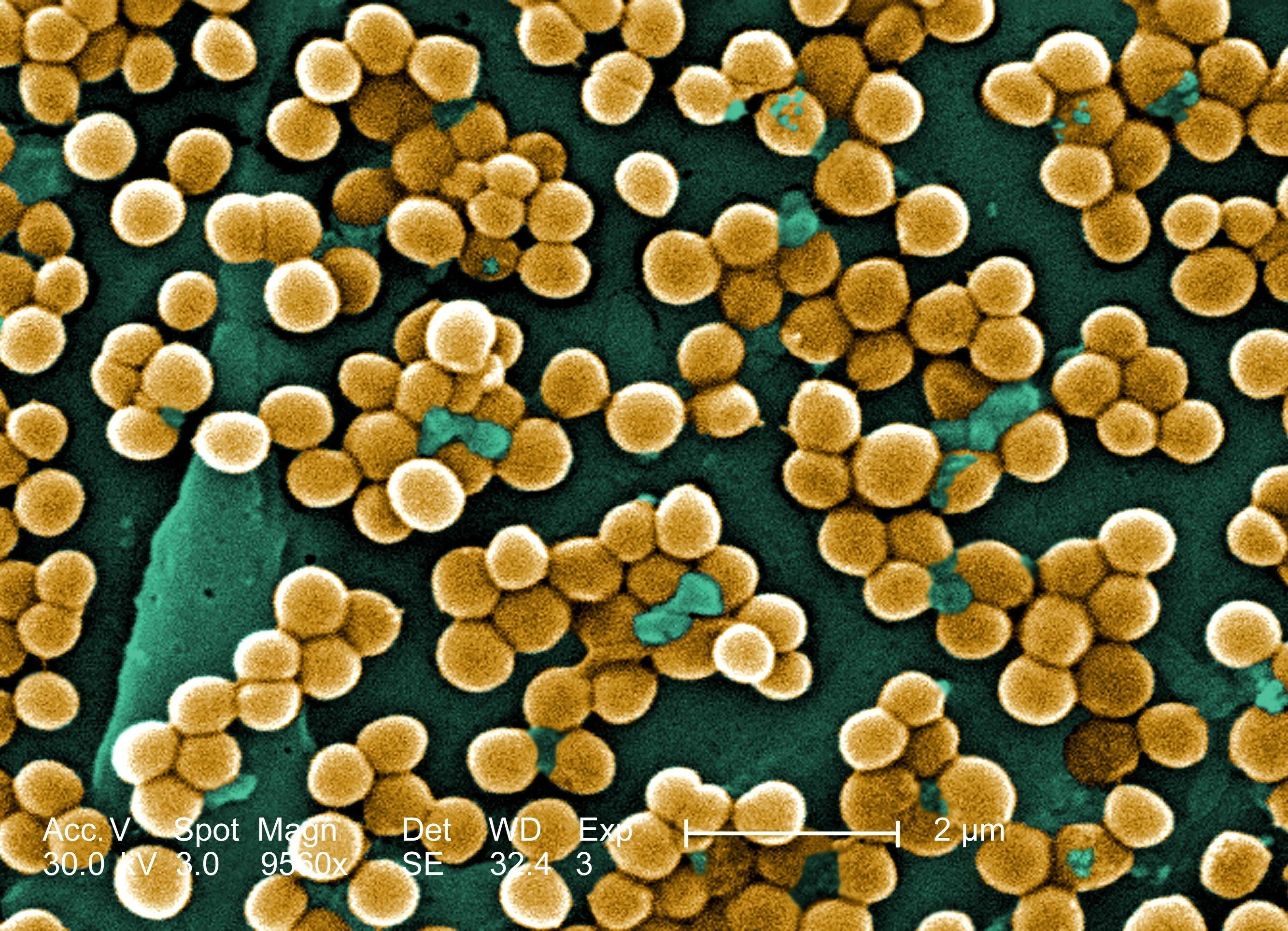 Метициллин-резистентный золотистый стафилококк. Золотистый стафилококк под микроскопом. Золотой стафилококк под микроскопом. Штаммы золотистого стафилококка.