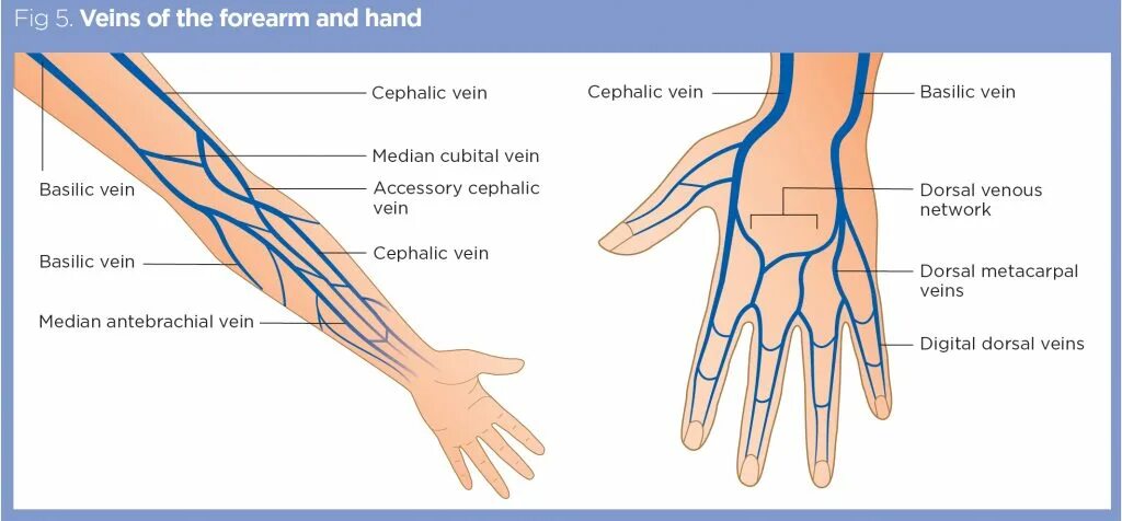 Good vein. Good vein. Вена кровеносный сосуд. Облитерирующий тромбофлебит. Кровоснабжение верхней конечности анатомия.