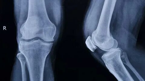 Кроссстерлер мен еркектер