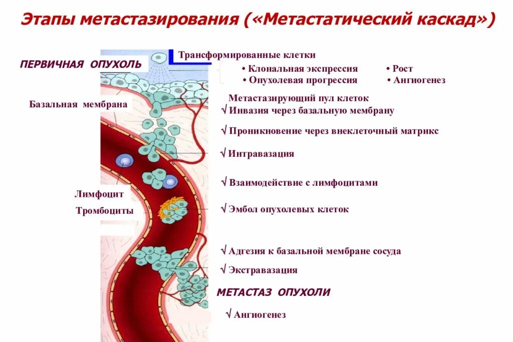 Пути метастазирования рака. Тканевой путь метастазирования. Механизм метастазирования злокачественной опухоли схема. Схема метастазирования опухолевых клеток. Механизмы инфильтрирующего роста и метастазирования опухоли.