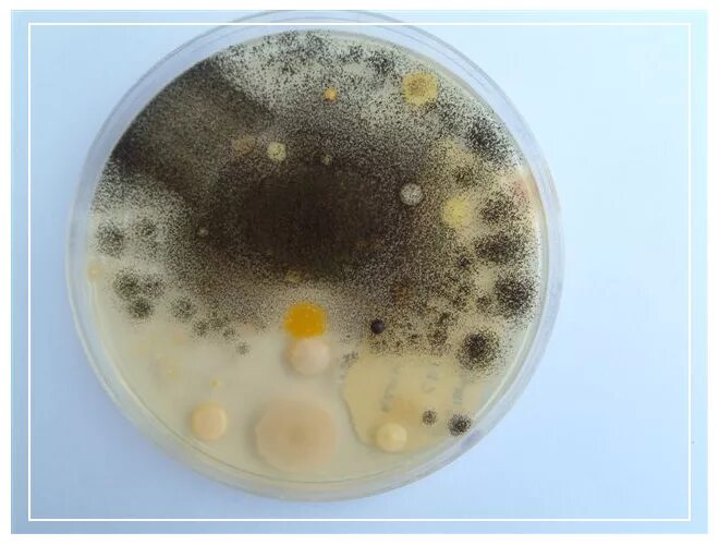 Колонии грибов в чашке петри. Колонии бактерий в чашке Петри. Плесень в чашке Петри. Чашка микробиологическая (Петри). Аспергилл плесень.