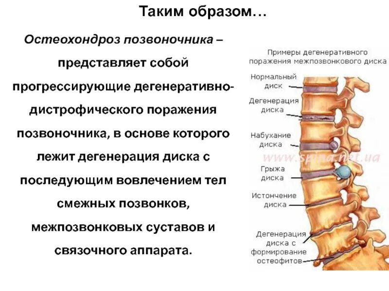 Межпозвонковый остеохондроз (поражение до 3 межпозвонковых дисков). Остеохондроз l2-s1 1-2 степени. Остеохондроз th12-l5 межпозвонковый. Спондилёз грудного отдела позвоночника что это такое.