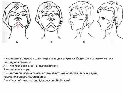 Разрезы на лице