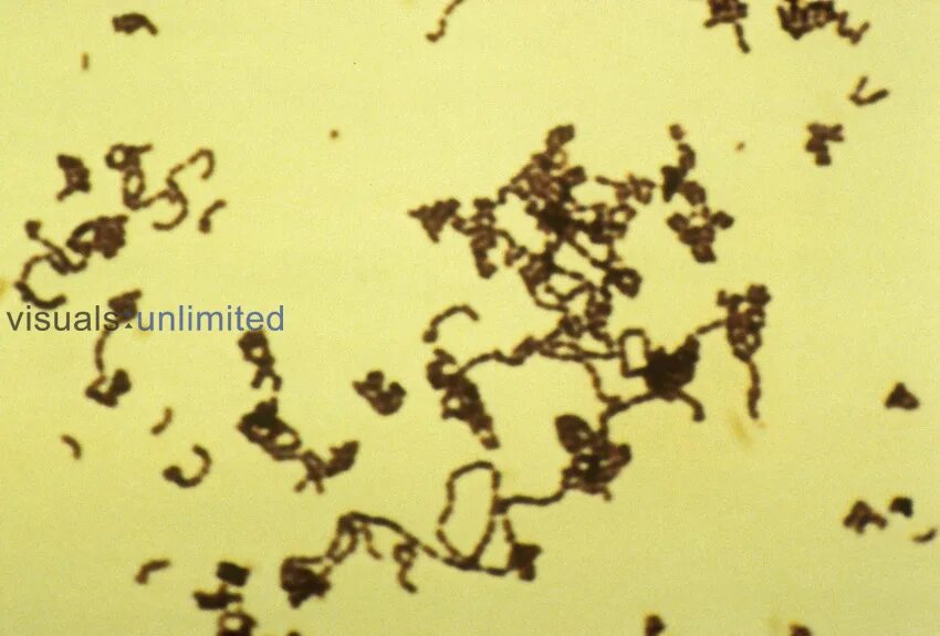 Peptostreptococcus. Стрептококки пептострептококки. Стрептококки вириданс под микроскопом. Peptostreptococcus Micros морфология. Пептострептококки по Граму.