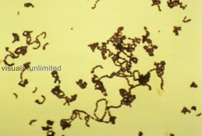 Streptococcus viridans у ребенка