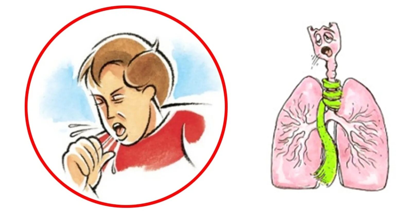 Став бронхит. Кашель. Человек кашляет рисунок. Кашель картинки. Кашель мультяшный.