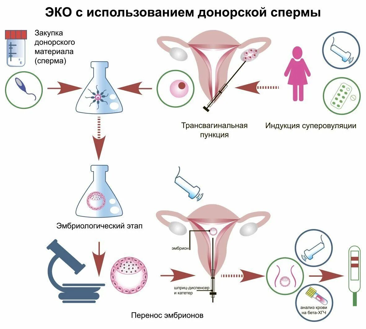 Экстракорпоральное оплодотворение схема. Схема оплодотворения женщины. Эко с донорской яйцеклеткой. Естественное оплодотворение.