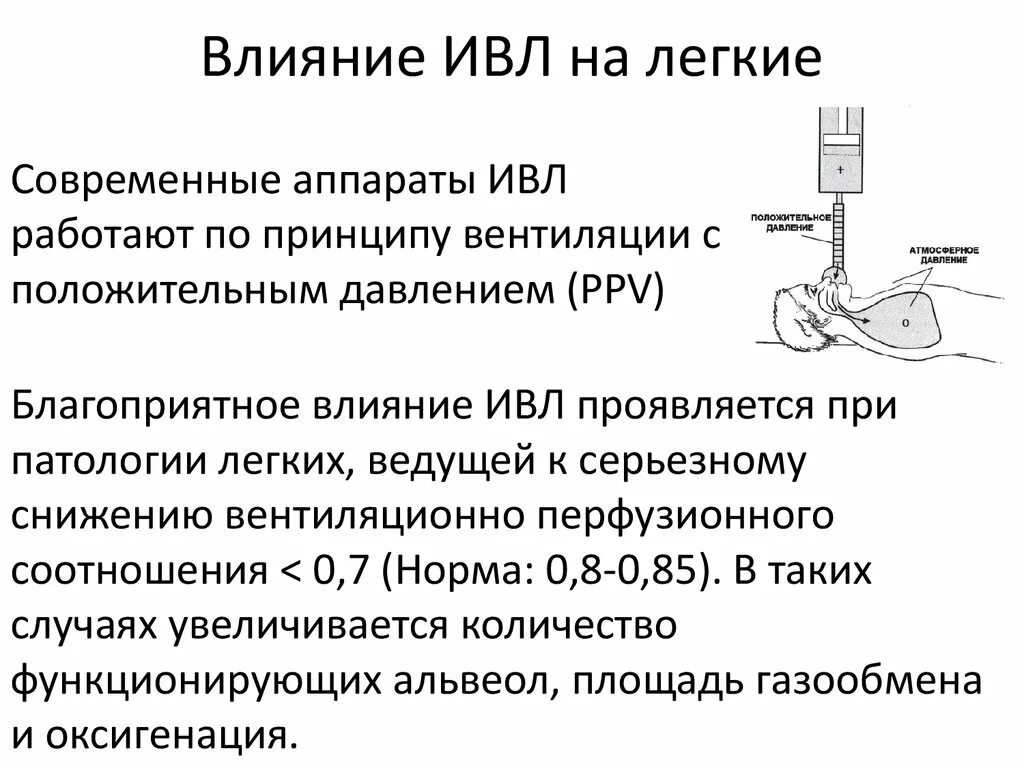 Аппараты искусственной вентиляции лёгких (ИВЛ. Подключение к аппарату искусственной вентиляции легких. Аппаратная вентиляция легких.