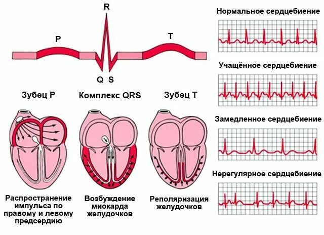 Замедление сердечных сокращений