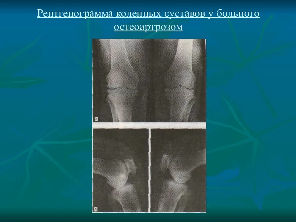 Образования деформирующего