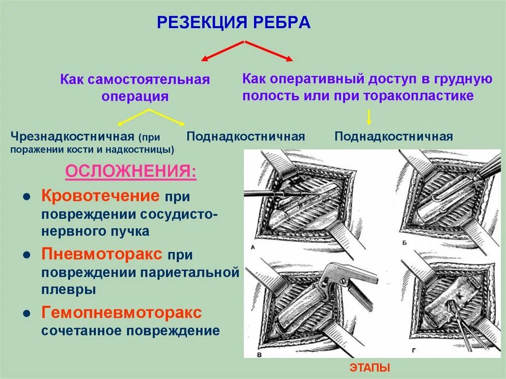 Сосудистые пучки это. Резекция ребра Оперативная хирургия. Поднадкостничная резекция ребра. Резекция ребра топографическая анатомия.