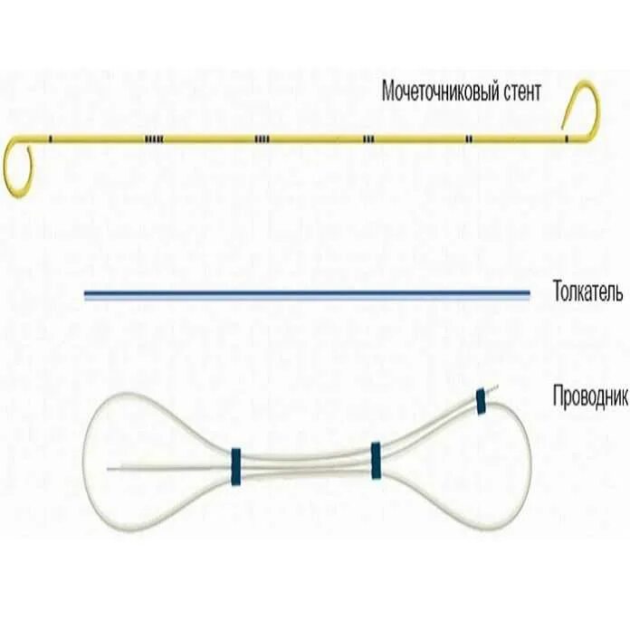Стент мочеточника отзывы. Катетер стент мочеточниковый. Катетер стент мочеточника. Мочеточниковый стент внутренний 2х петлевой. Стент внутреннего дренирования почки.