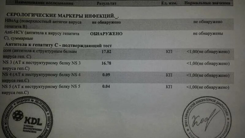 Анализ на гепатит. Анализы гепатит а положительно. Результаты анализов на гепатит. Исследование крови на гепатиты в и с. Вич hcv hbsag