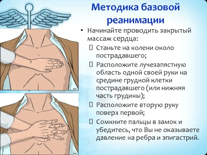 При непрямом массаже сердца пальцы располагаются. Закрытый массаж сердца. при проведении закрытого массажа сердца руки. расположение рук при сердечно легочной реанимации. руки на грудной клетке при сердечно легочной реанимации.