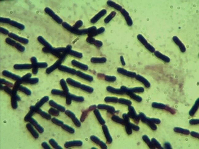 Clostridium butyricum бактерия. Клостридии бутирикум. CL. Butyricum. Маслянокислые бактерии рода Clostridium.