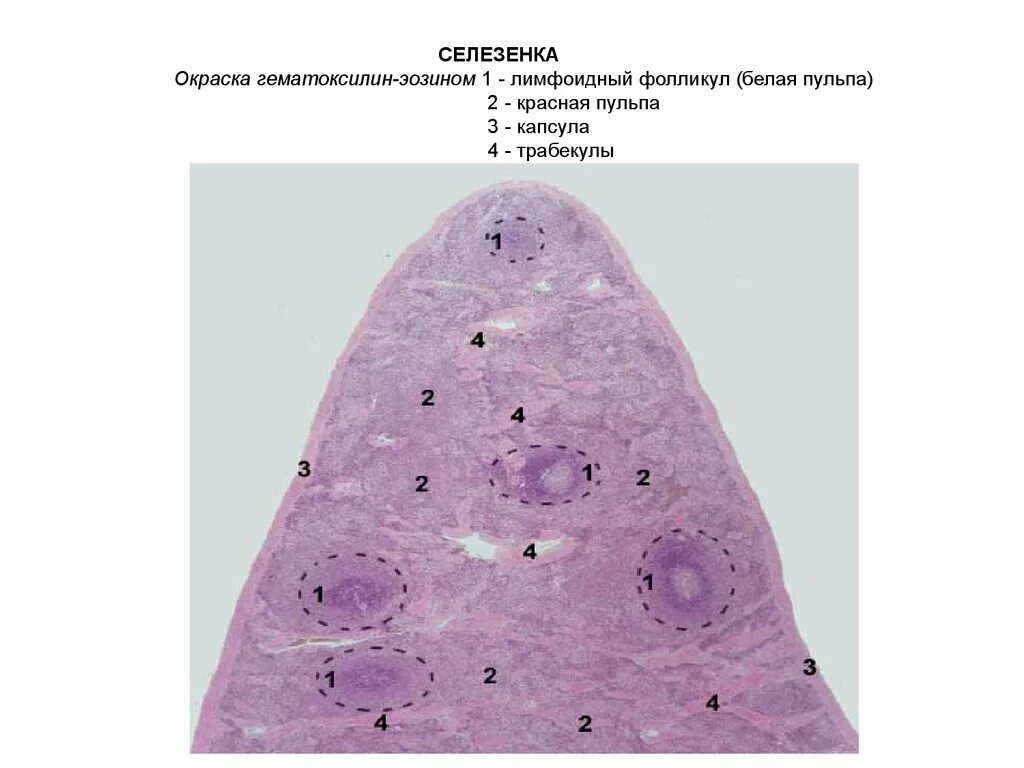 Селезенка гистология препарат. Селезенка окраска гематоксилин-эозином. Препарат селезёнка окраска гематоксилин-эозин. Селезенка гематоксилин эозин. В селезенке образуются клетки