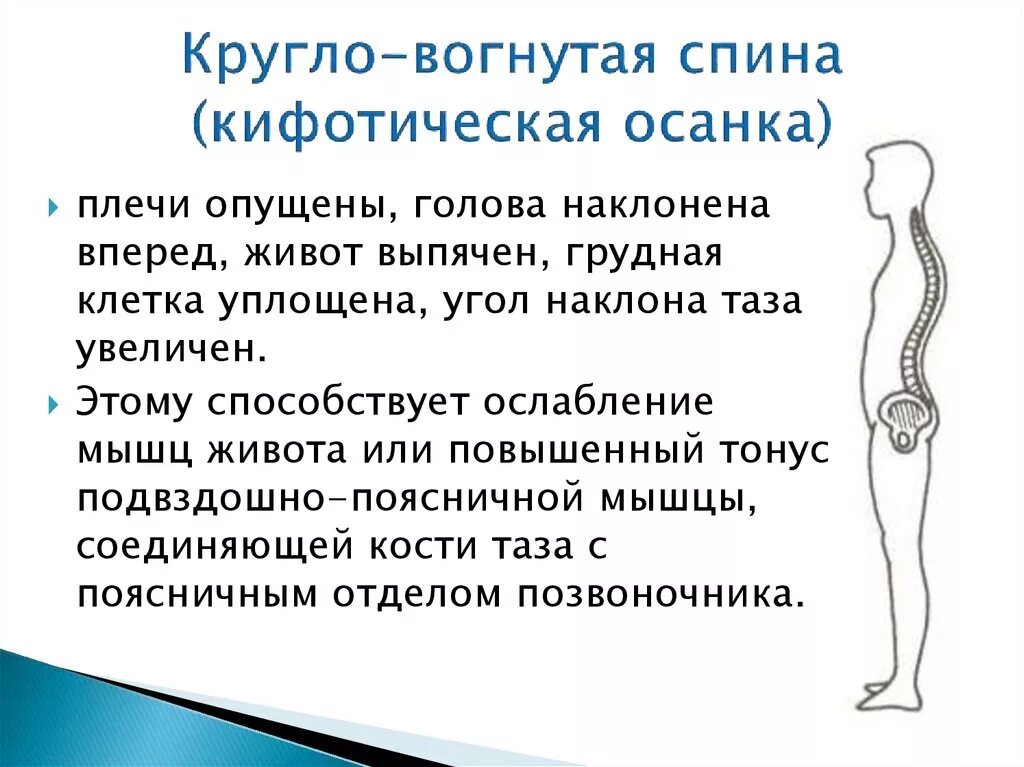 Какие мышцы осанку