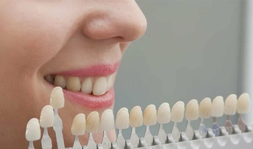 Палитра стоматология