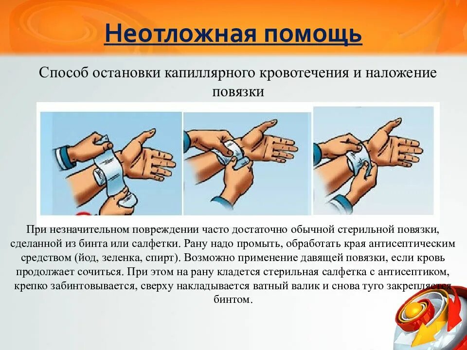 При каком кровотечении применяется