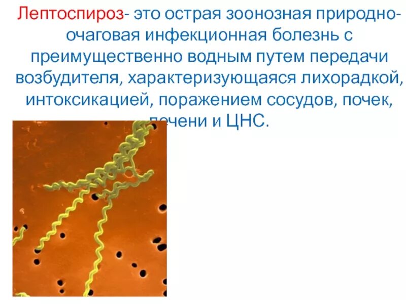 Инфекция лептоспироз. Лептоспироз переносчики инфекции. Лептоспироз возбудитель болезни. Лептоспироз собак патанатомия.